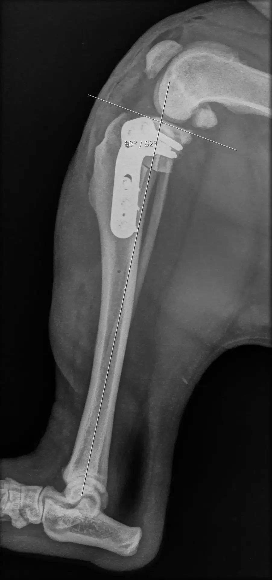 Orthopedie