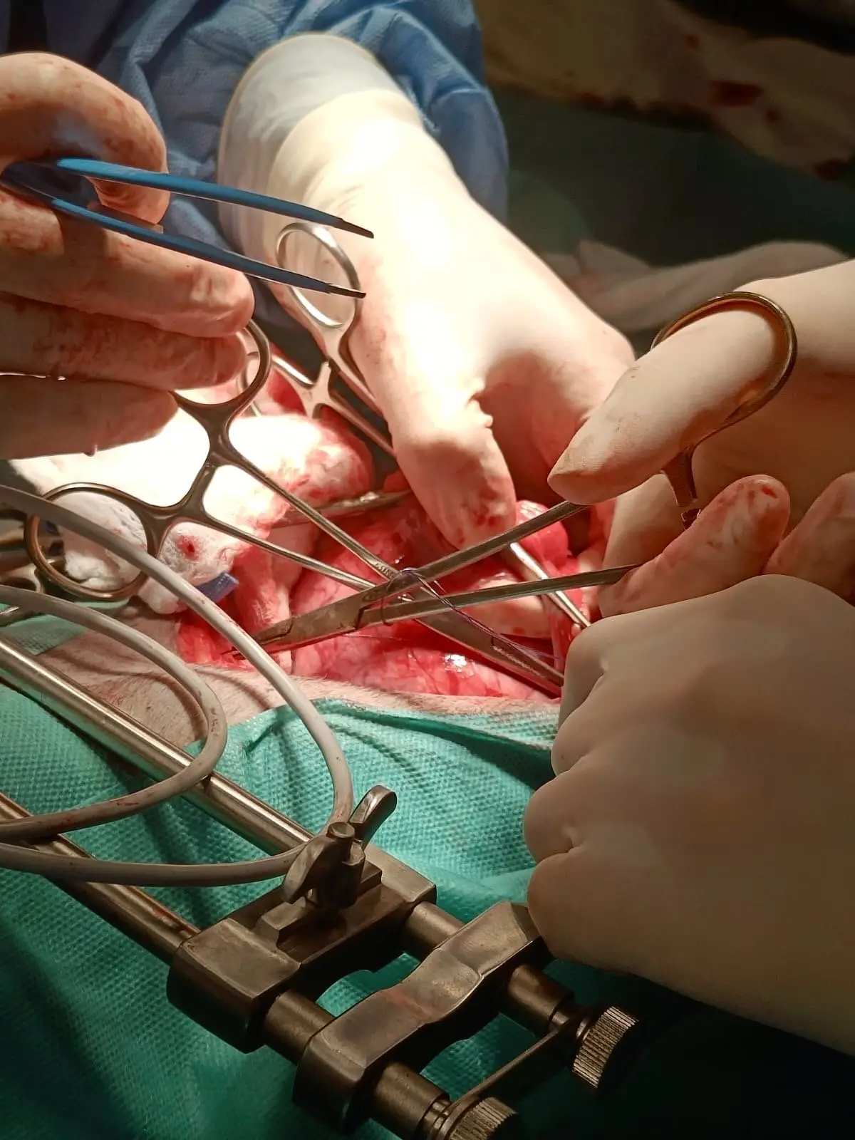 Chirurgie